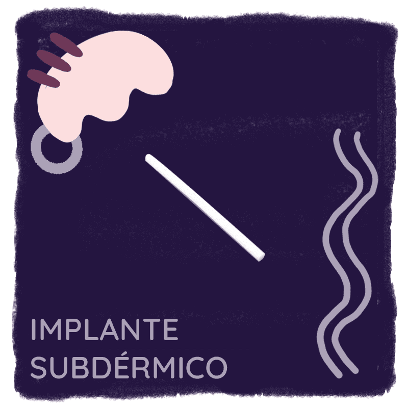 Método MAC - Implante subdérmico anticonceptivo